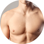 גניקומסטיה