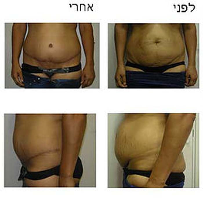 דר שופאני עזיז – מומחה לכירורגיה פלסטית