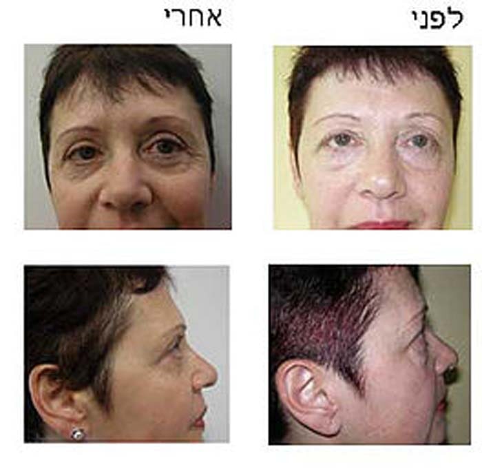 דר שופאני עזיז – מומחה לכירורגיה פלסטית