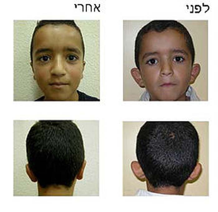 דר שופאני עזיז – מומחה לכירורגיה פלסטית